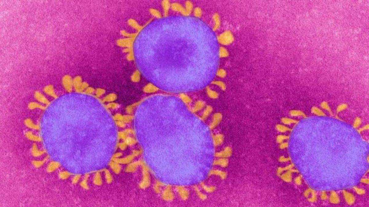 Sitokin fırtınası nedir