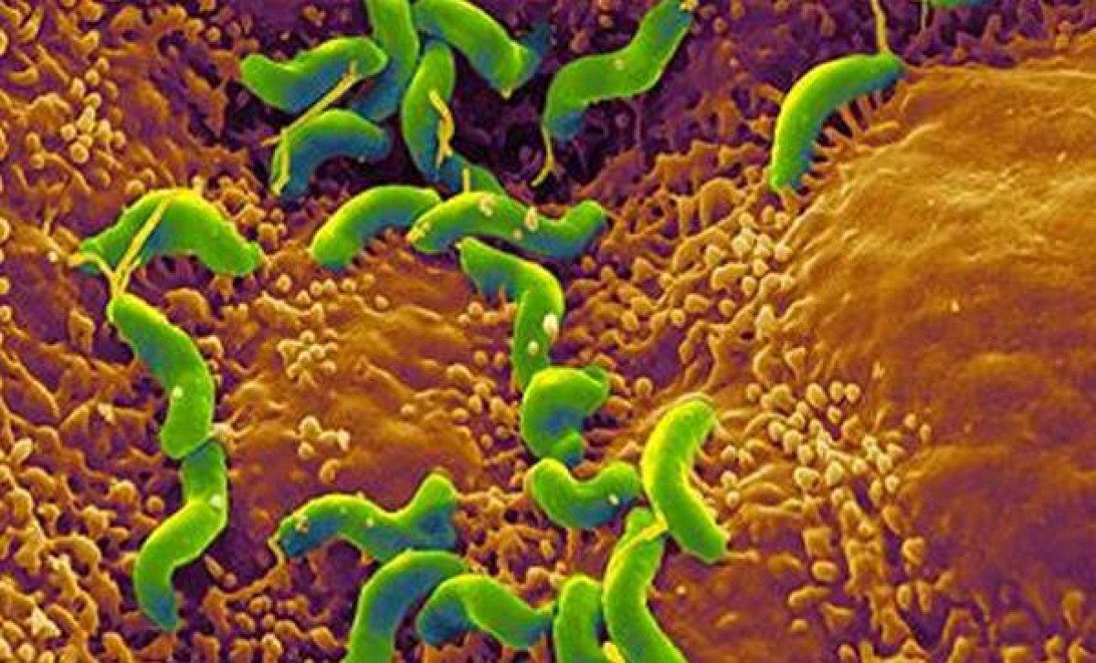 Helikobakter pilori nedir