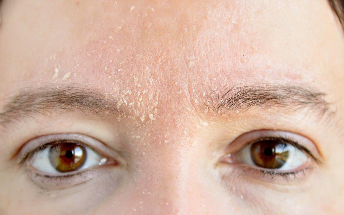 Cilt kuruluğunu önleyen 8 vücut yağı