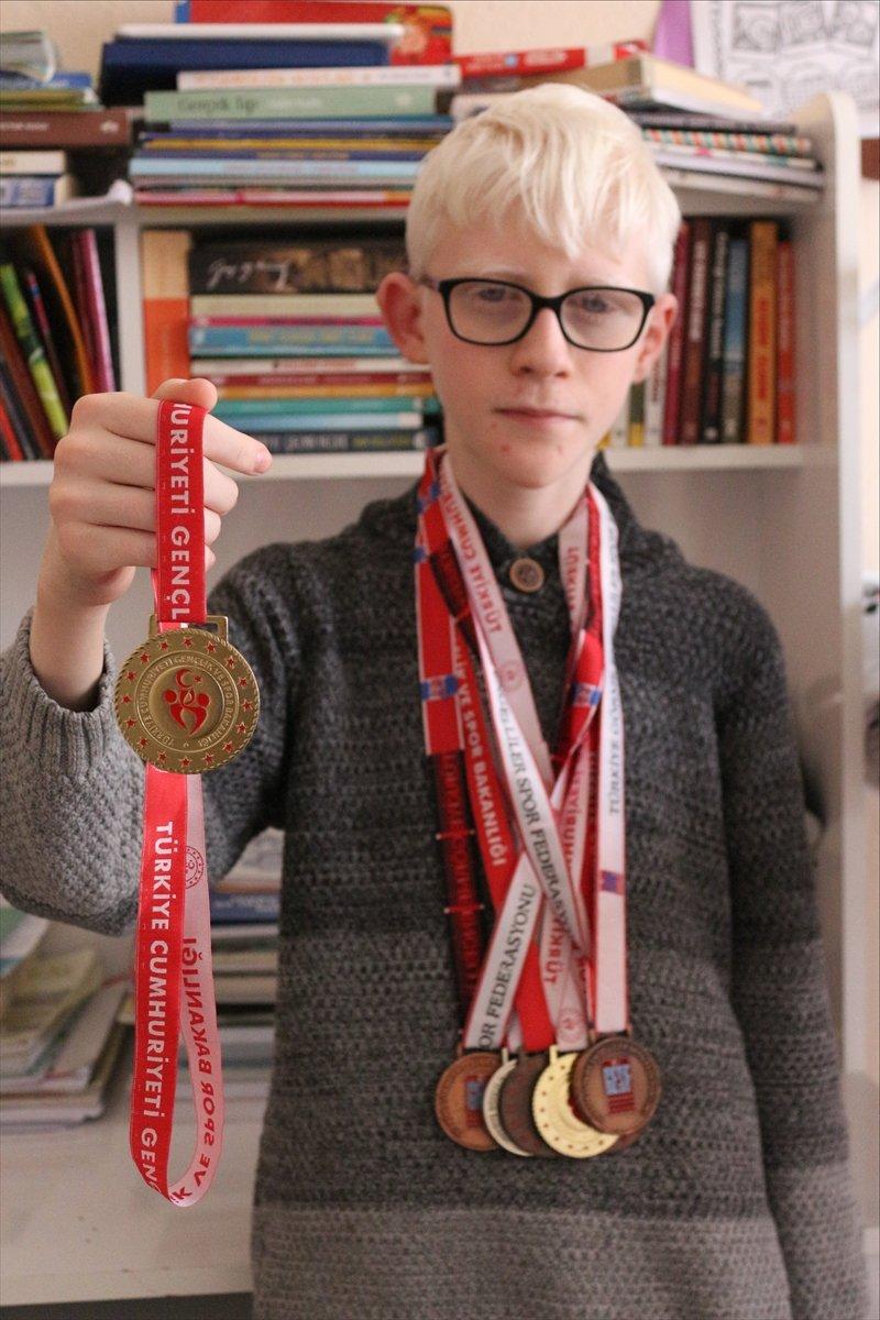 Konya'da Albinizm hastası Hüseyin Ali, azmiyle kendisi gibi çocuklara cesaret veriyor