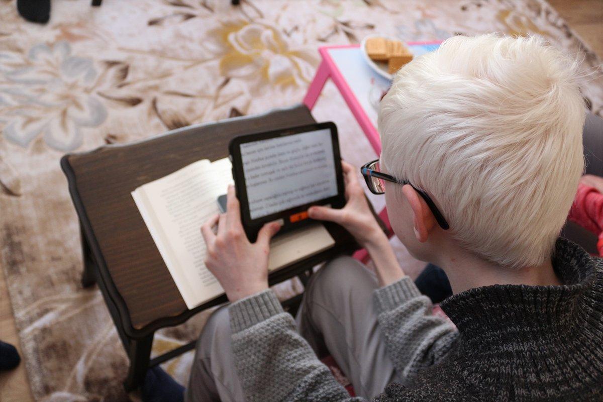 Konya'da Albinizm hastası Hüseyin Ali, azmiyle kendisi gibi çocuklara cesaret veriyor