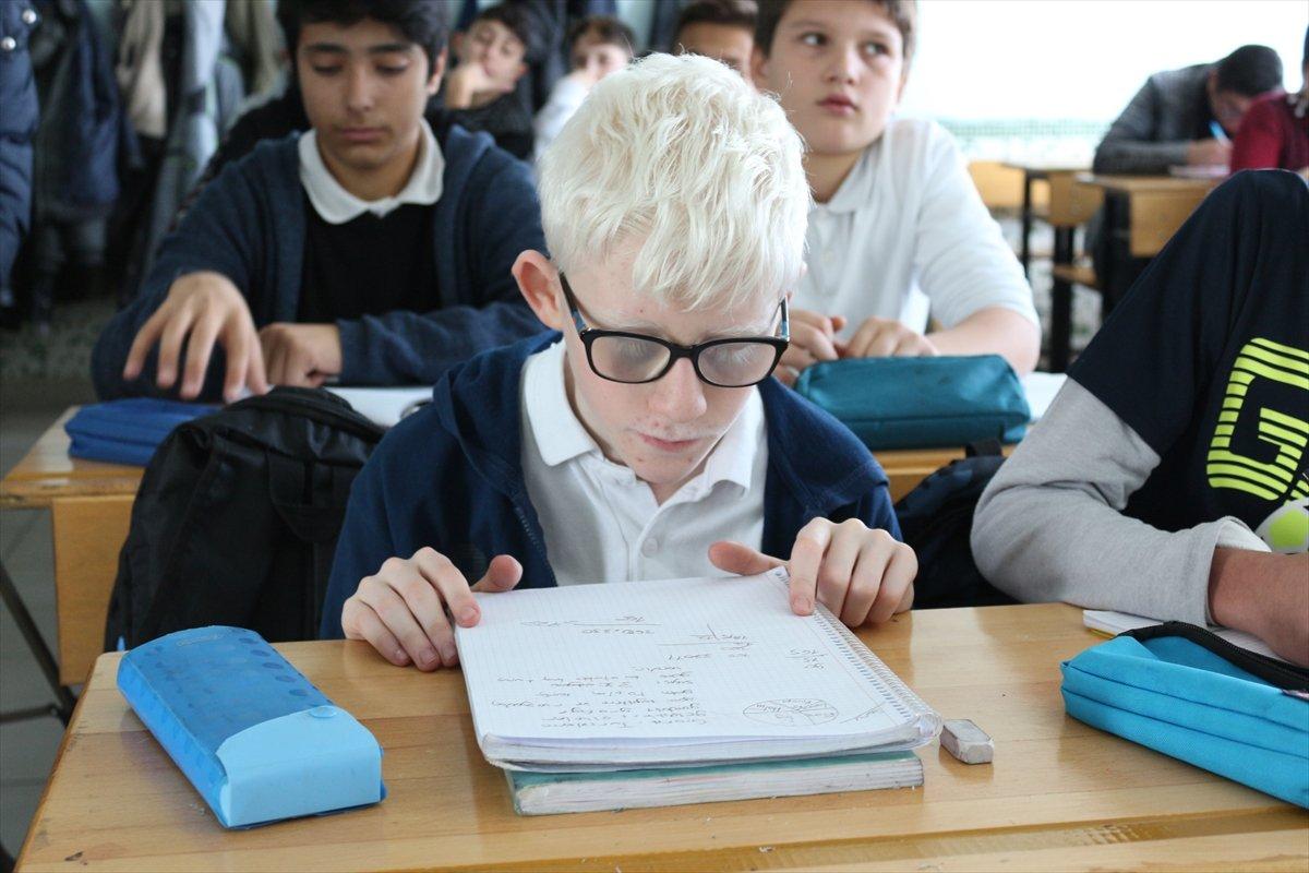 Konya'da Albinizm hastası Hüseyin Ali, azmiyle kendisi gibi çocuklara cesaret veriyor