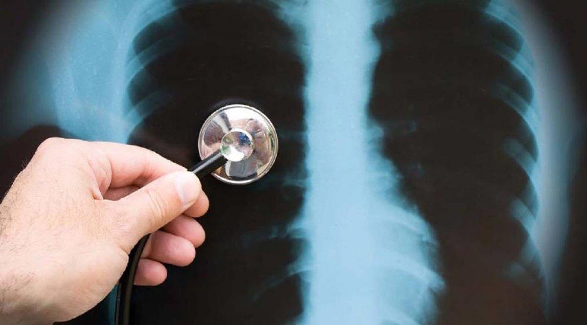 Koronavirüs öksürüğü nasıl anlaşılır? Koronavirüs ve kuru öksürük farkı nedir?