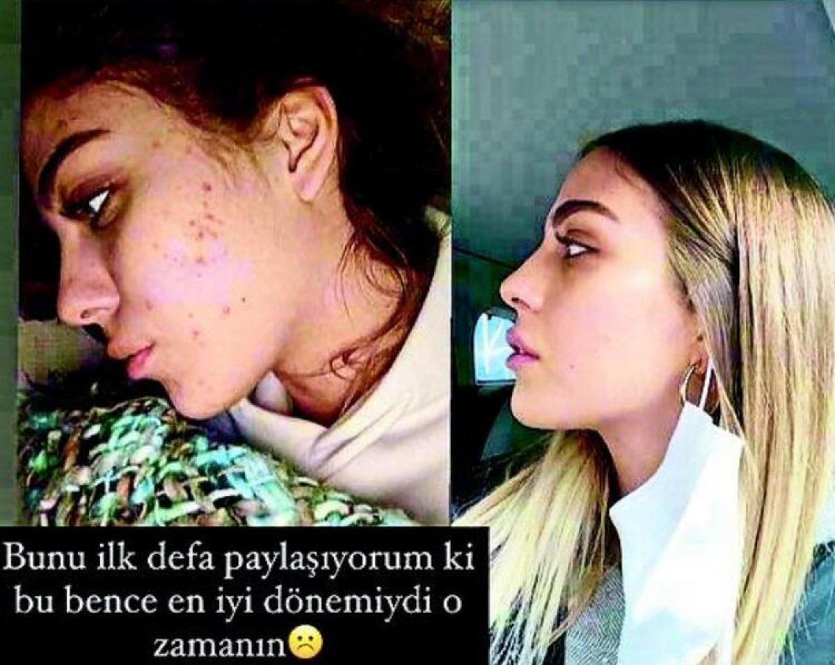 Yasemin Şefkatli: Estetiğim var