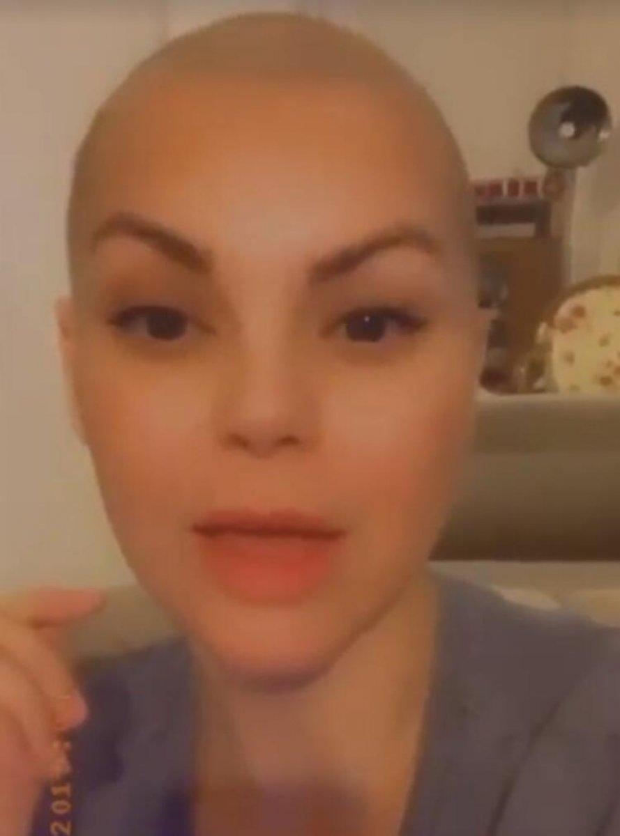 Nez saçlarını kazıttı