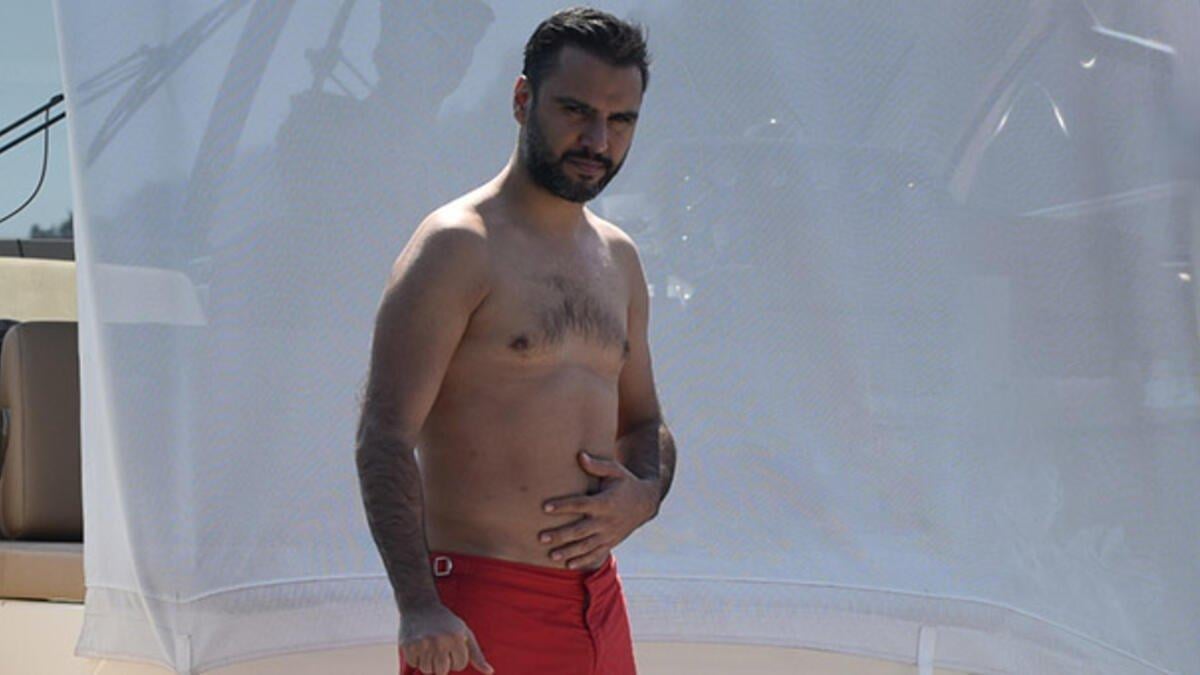 Alişan: Liposuction yaptırdım, ölümden döndüm