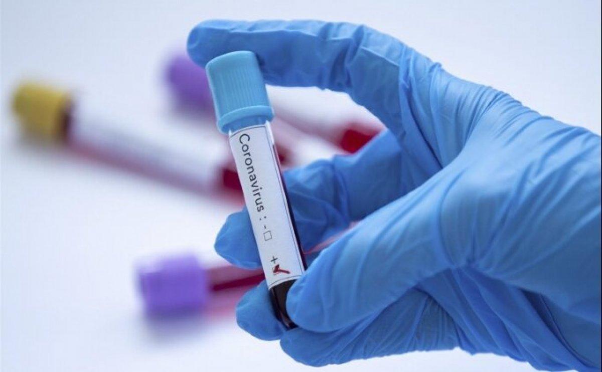 Keçiörengücü'nde koronavirüs vakası