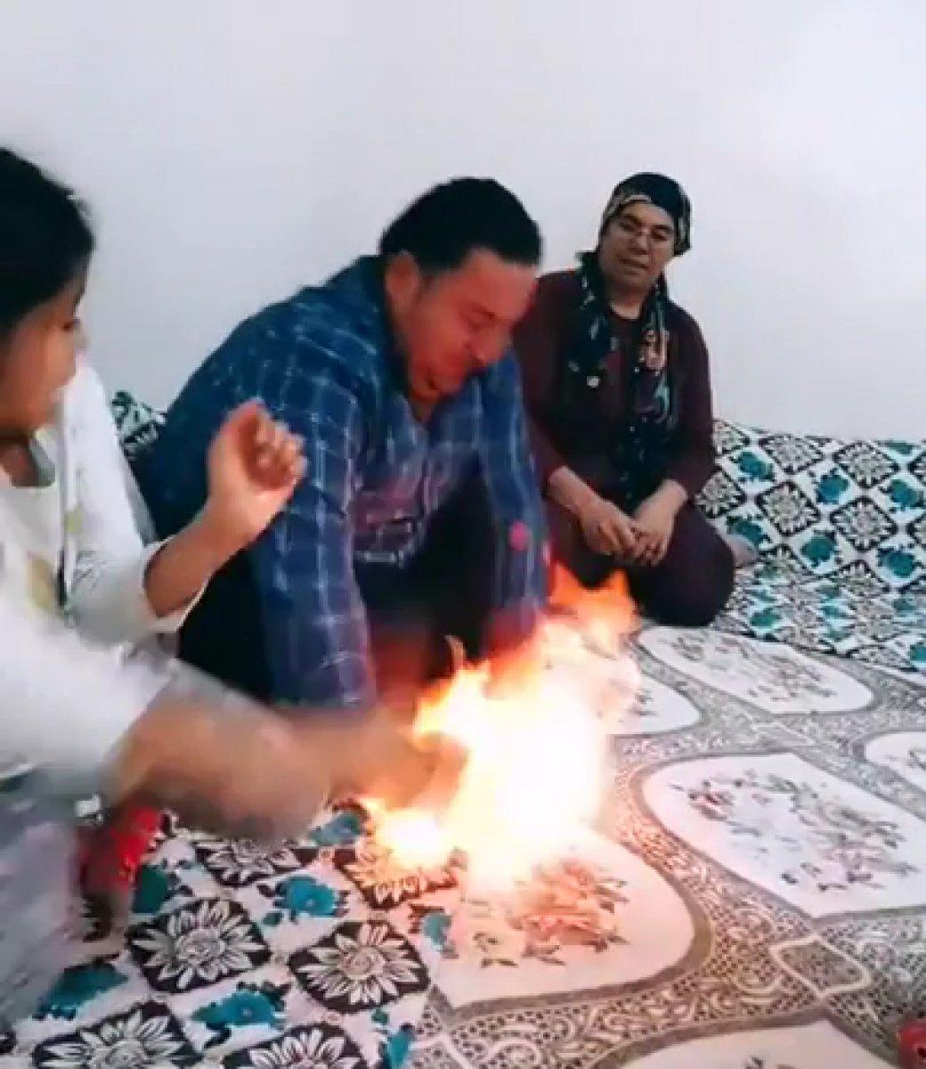 TikTok videosu için eşinin ellerini çakmakla yaktı