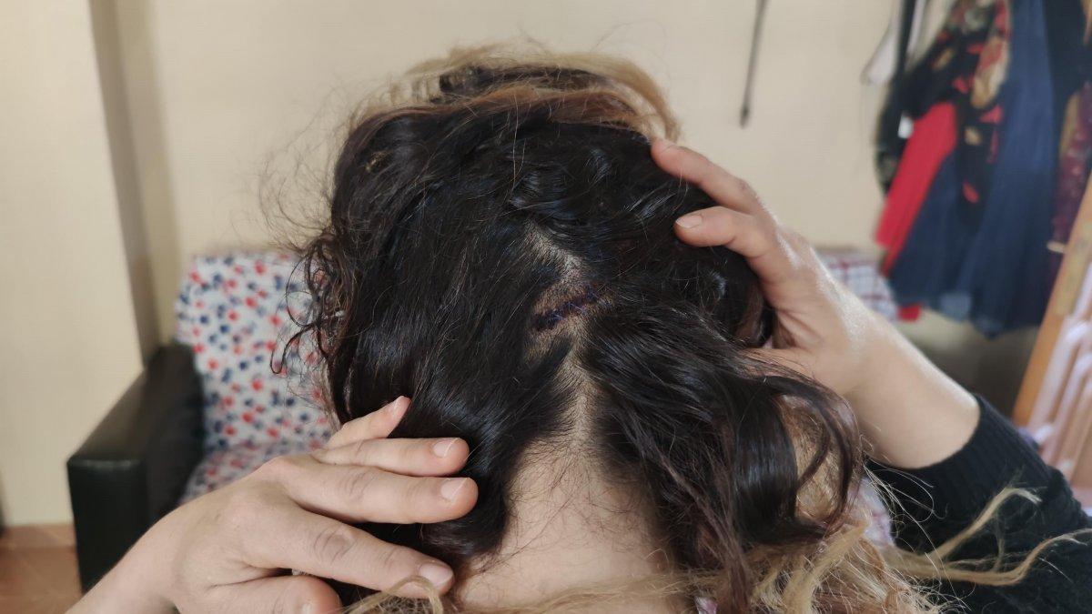 Osmaniye'de arkadaşının eşi tarafından darbedildi