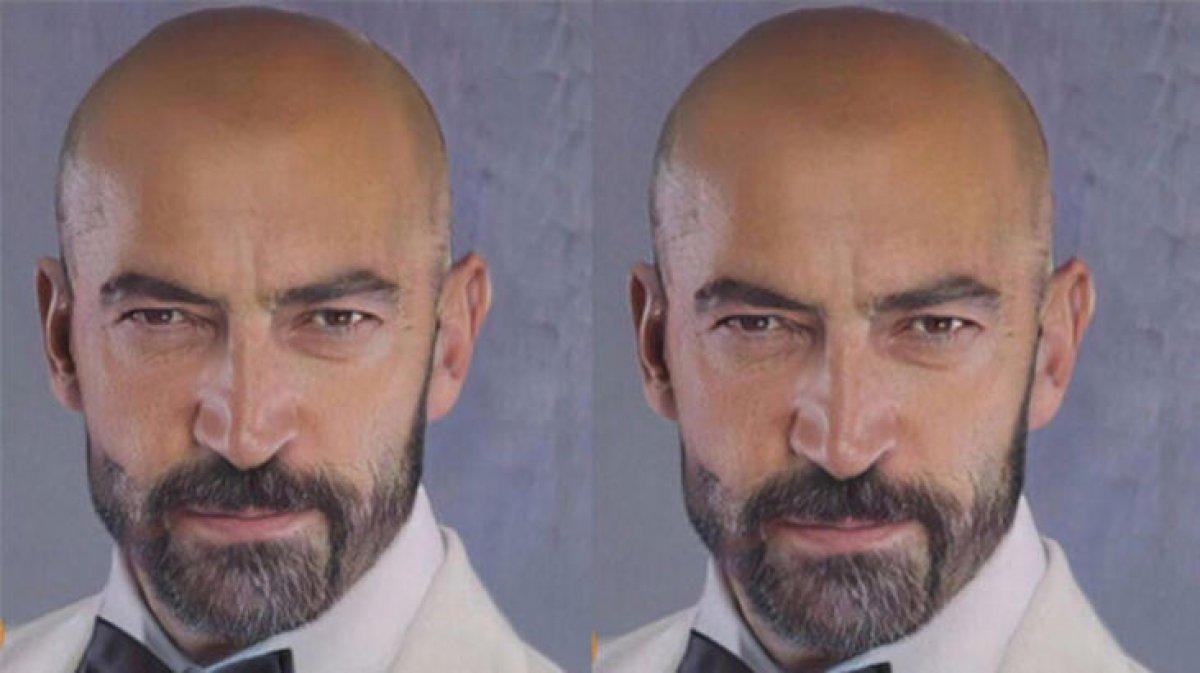 Kenan İmirzalıoğlu saç ektirdi