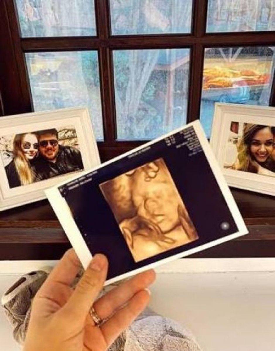 Berfu Yenenler: Mete emmi yüzünü gösterdi