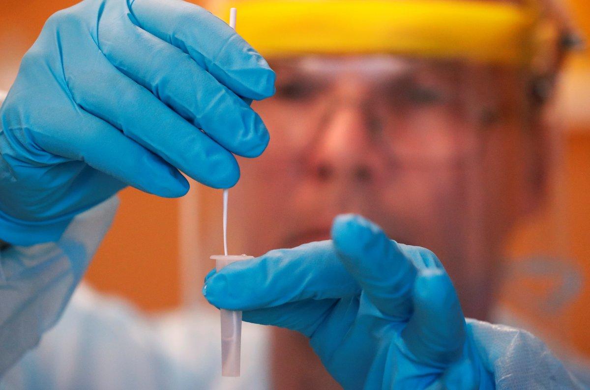 Almanya'da binden fazla Türk, koronavirüsten hayatını kaybetti