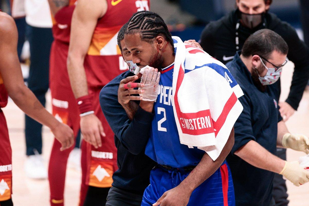 Kawhi Leonard kanlar içinde kaldı