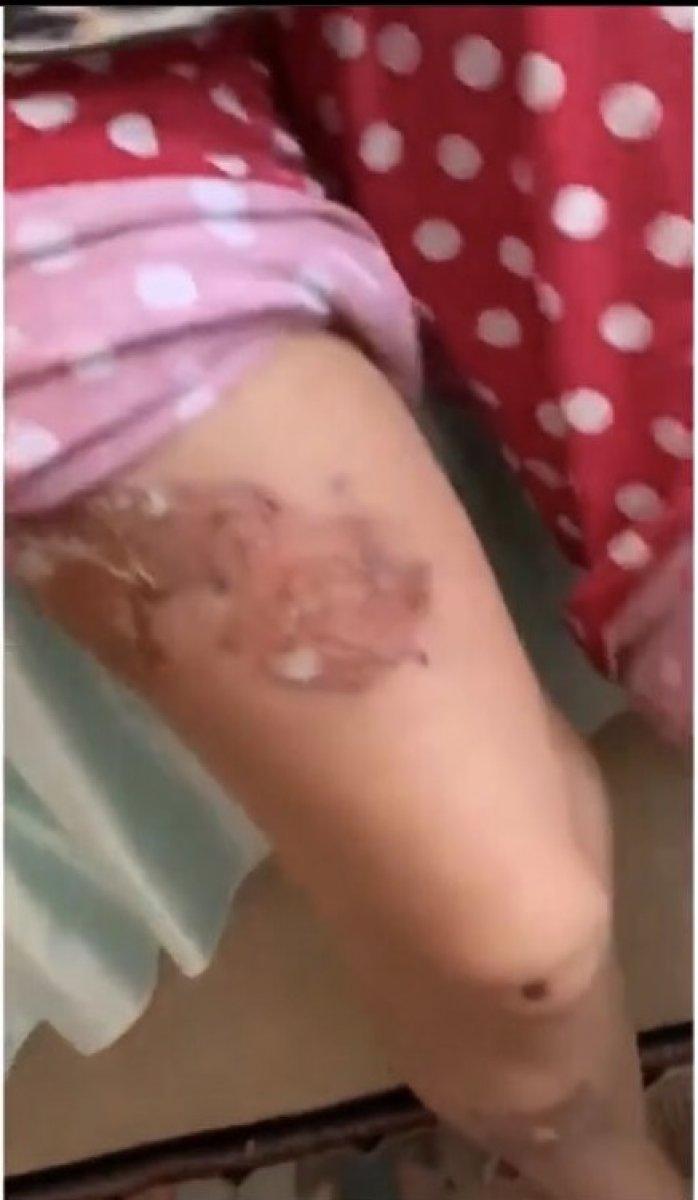 Sancaktepe’de eşine kızgın bıçakla işkence eden koca kendini savundu