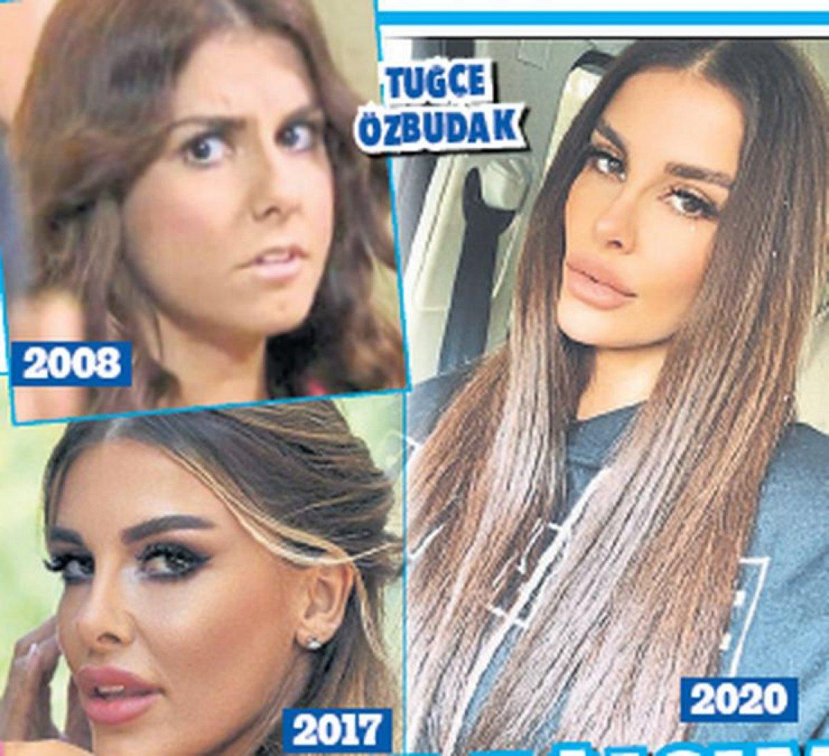 Tuğçe Özbudak: Yüzümde hiç bıçak izi yok