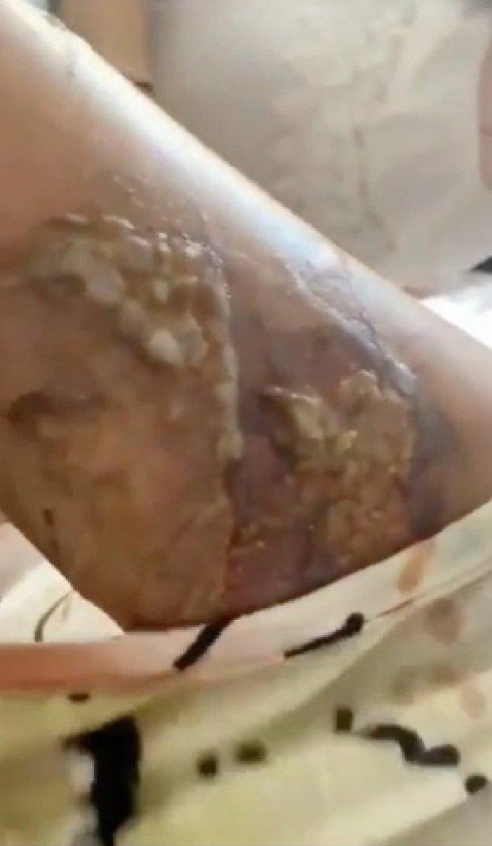 Sancaktepe’de eşine kızgın bıçakla işkence eden koca kendini savundu