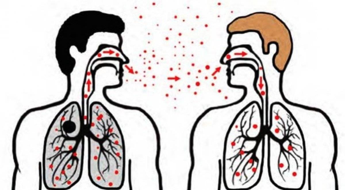 Sinsi hastalık veremin erken teşhisi hayat kurtarıyor