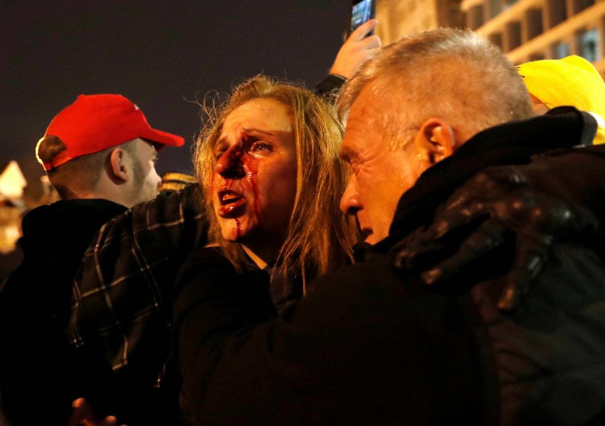 ABD'de polis ile Trump destekçileri arasında arbede