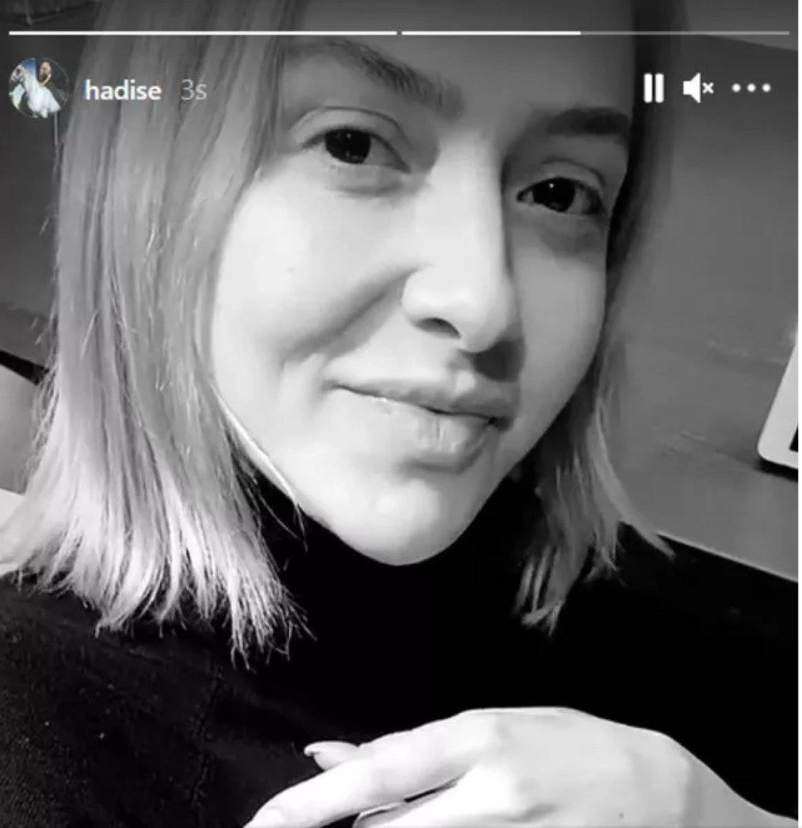 Hadise'nin doğal hali