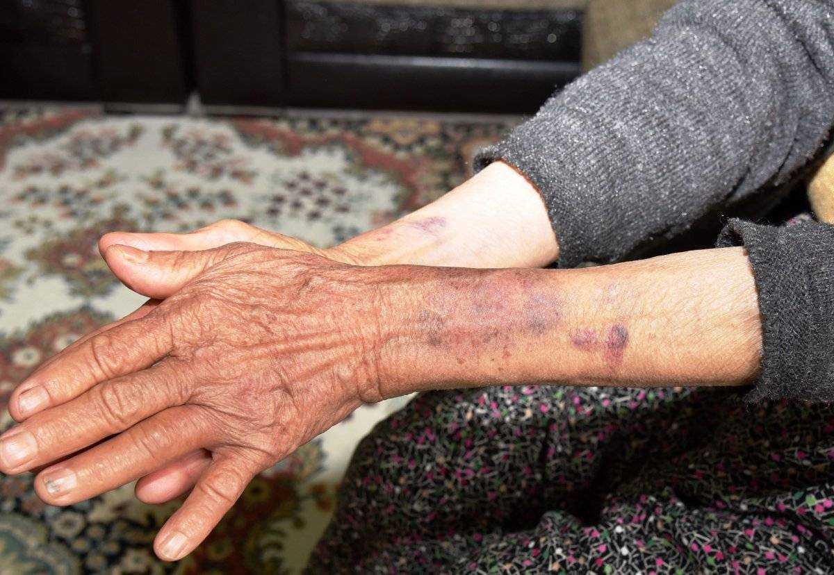 Antalya'da yaşlı kadını darbedip, 10 bileziğini çaldılar