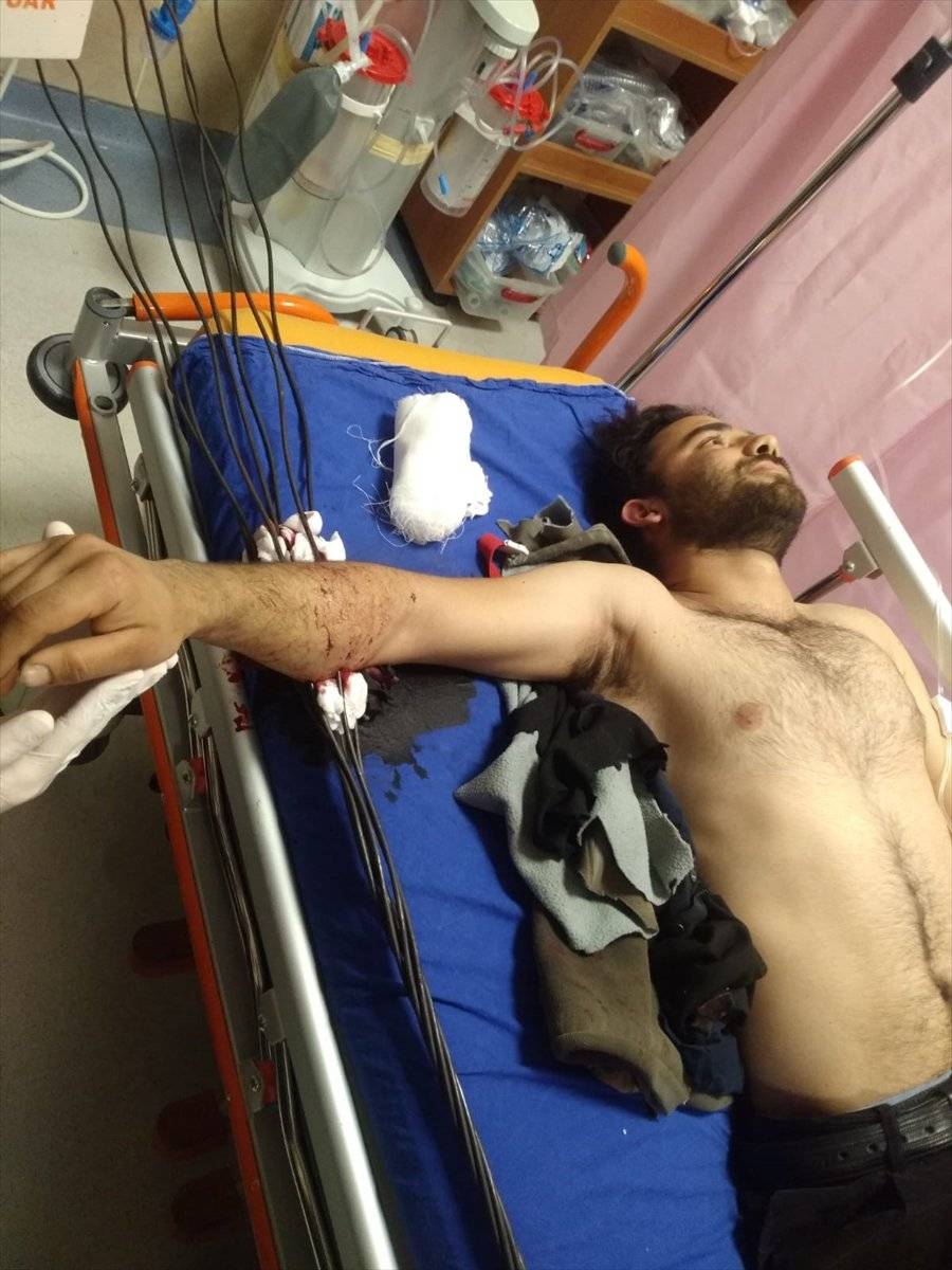 Sivas'ta YHT inşaatında koluna çelik tel saplanan işçi yaralandı