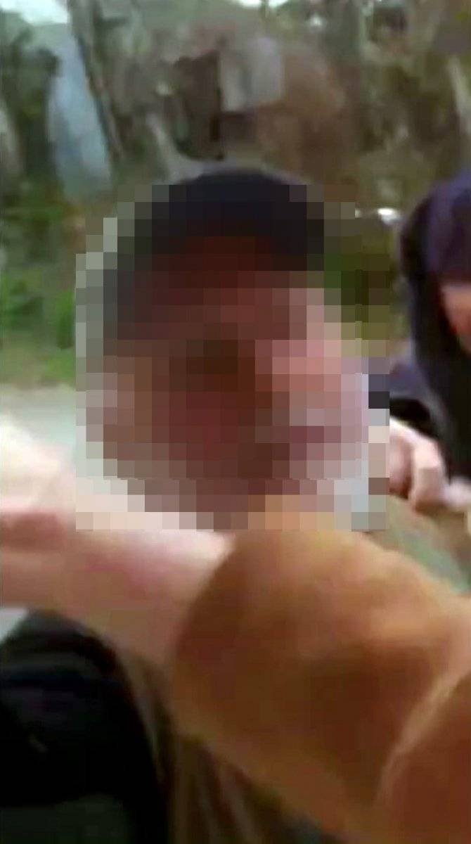 Sakarya'da genç kız, köpeğin üzerine bastığı için uyardığı komşusu tarafından darbedildi