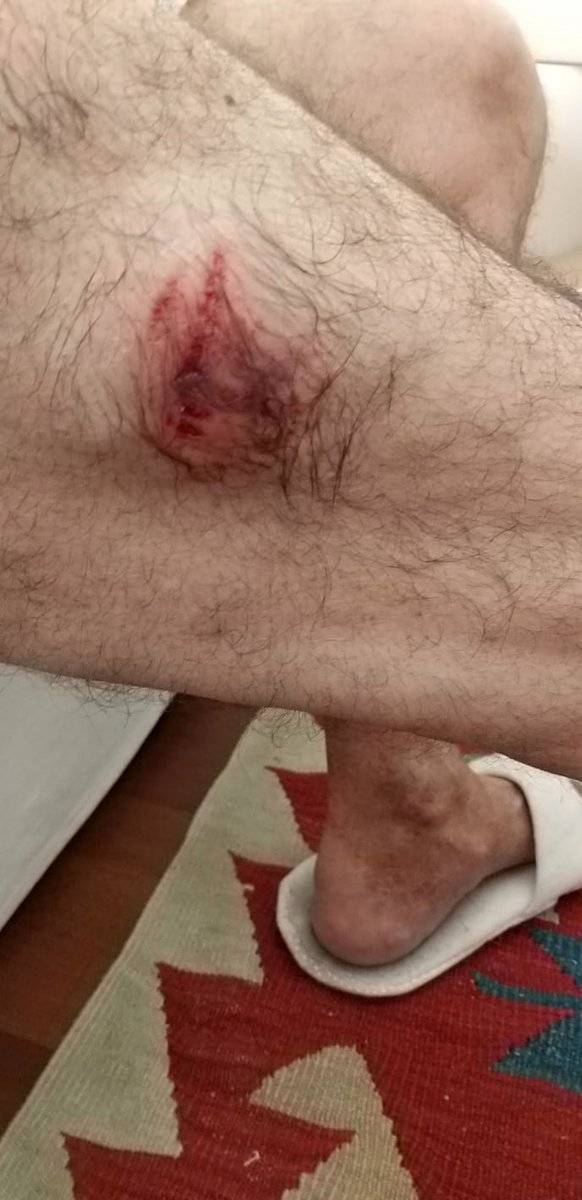 Antalya'da spor ve yürüyüş yapanların korkulu rüyası 'lastik çetesi'