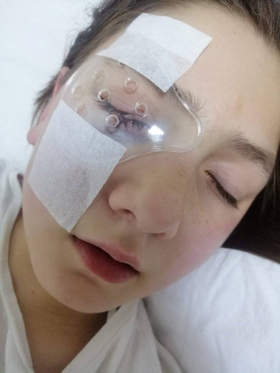 Aydın'da, yastık savaşı yaparken kırılan avize gözünü parçaladı