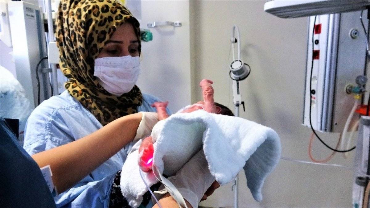 Tokat'ta tek ayaklı doğan prematüre bebek, yaşama tutundu