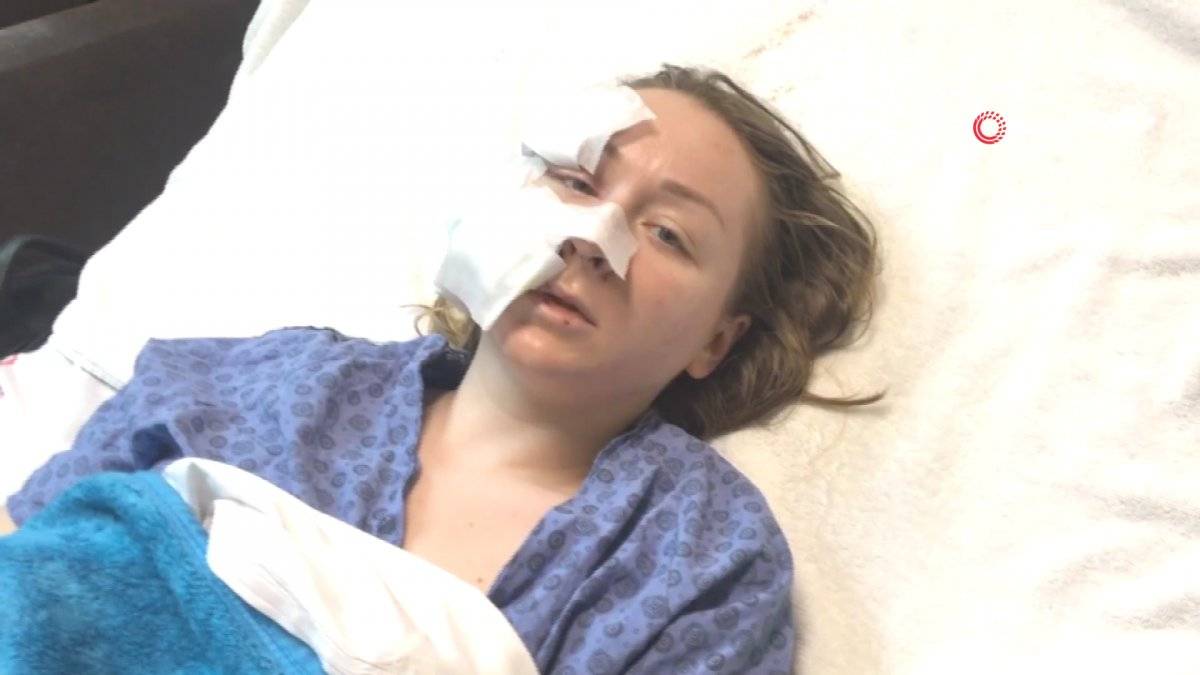 Falçatalı saldırıya uğrayan Anna: Saçımdan tutup, yüzümü kesti