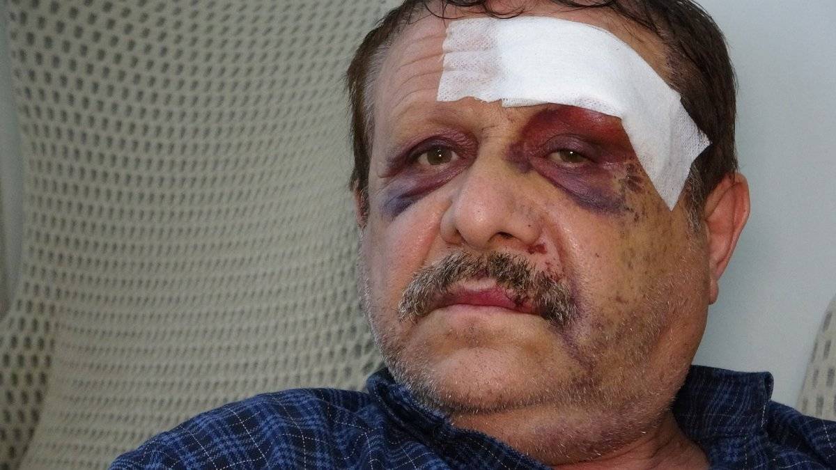 Gaziantep’te motosiklet tamircisi ölümden ikinci kez kurtuldu