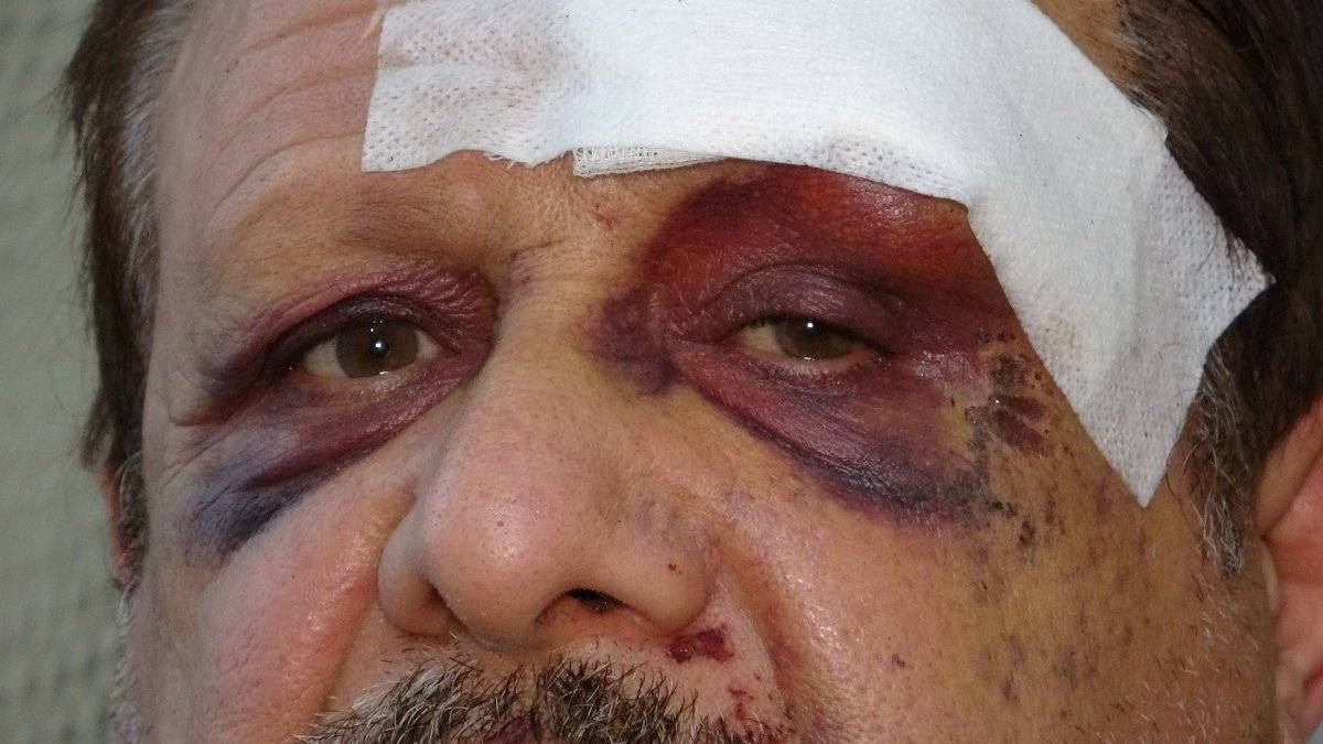 Gaziantep’te motosiklet tamircisi ölümden ikinci kez kurtuldu