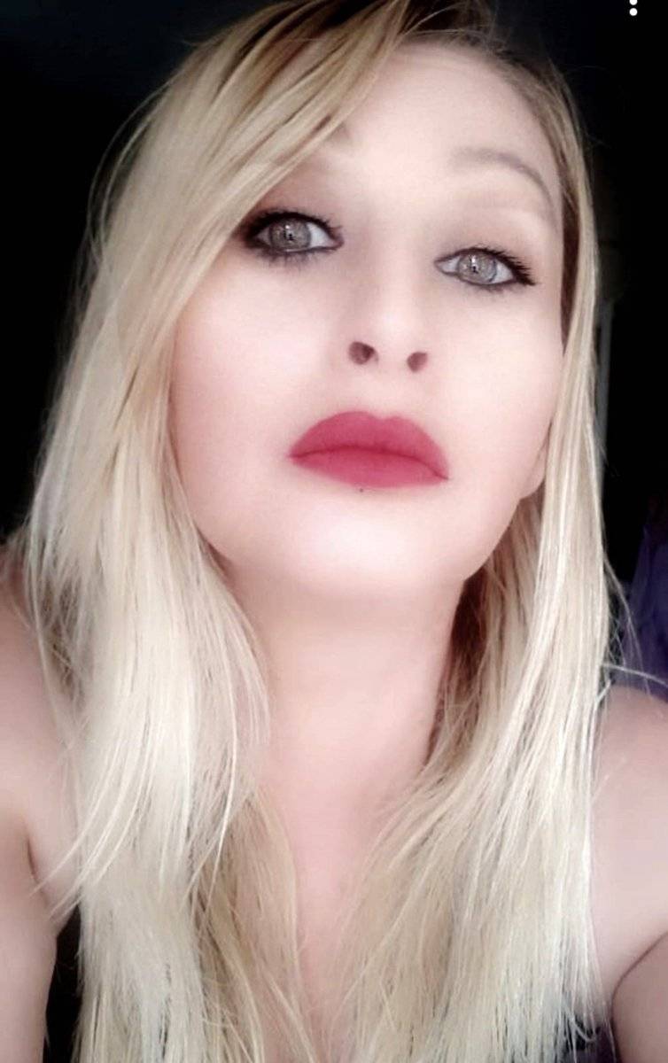 Antalya'da estetik sonrası kaybettiği dudağına yeniden kavuşuyor