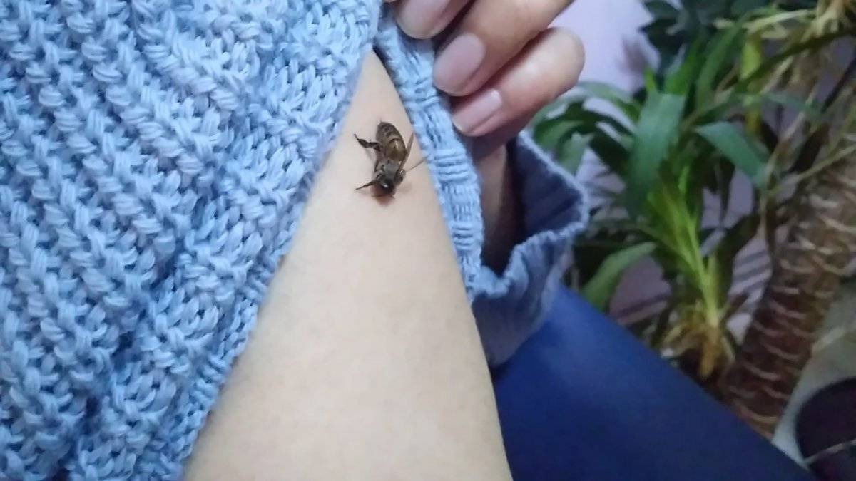 Malatya'da koronavirüse karşı kendilerini bal arılarına ısırttırıyorlar