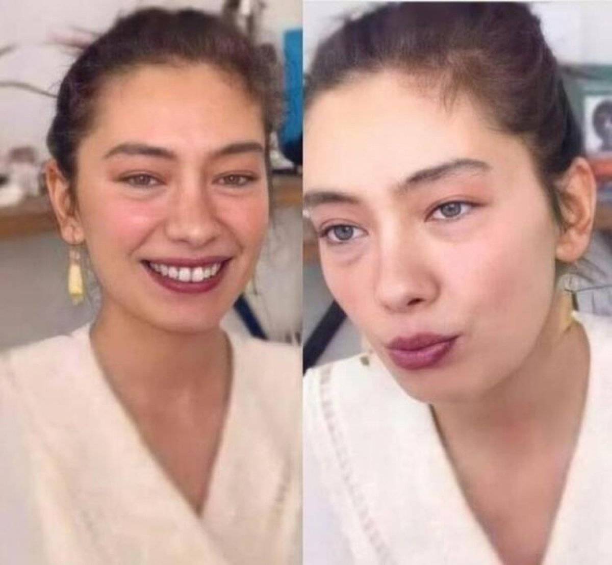 Neslihan Atagül'ün son hali sevenlerini üzdü