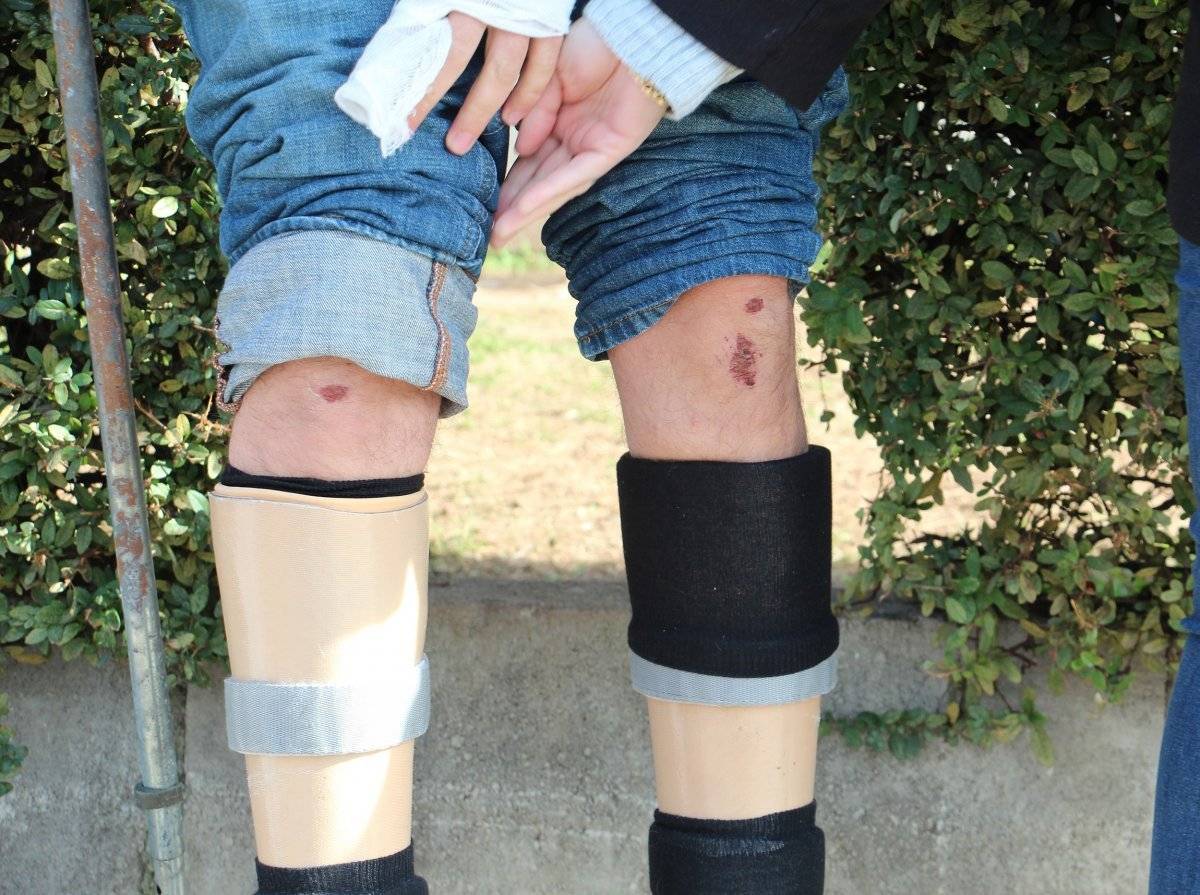 Antalya'da gazi Gökhan Koç'u darbeden baba ile oğlu gözaltına alındı