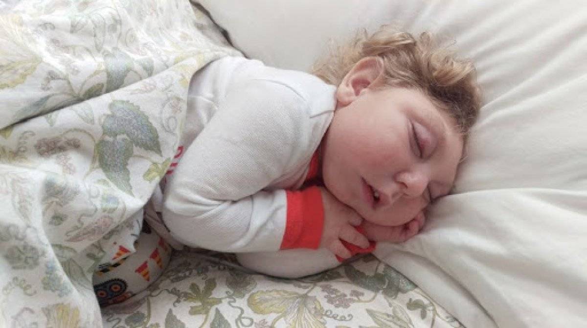 Mikrosefali hastalığı nedir? Mikrosefali hastalığı belirtileri nelerdir? Mikrosefali nedenleri ve tedavisi..