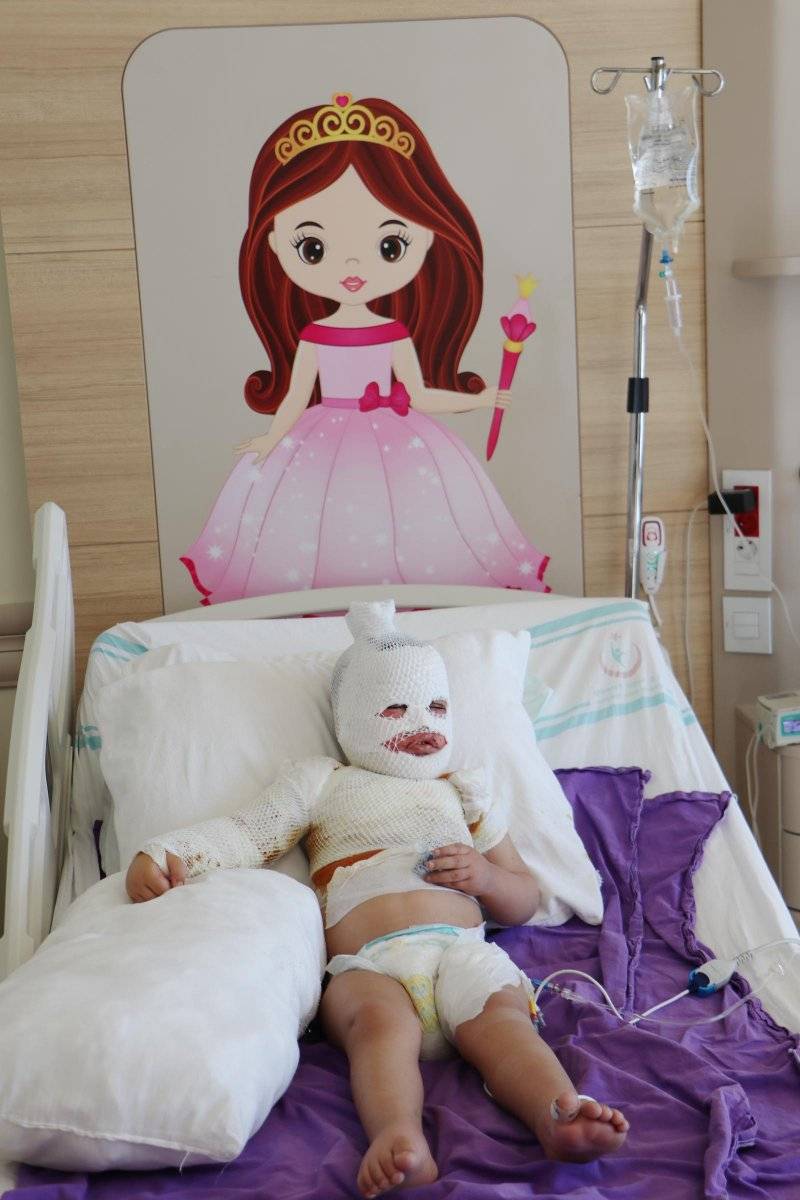 Kars'ta 2 yaşındaki çocuğun üzerine çaydanlık devrildi