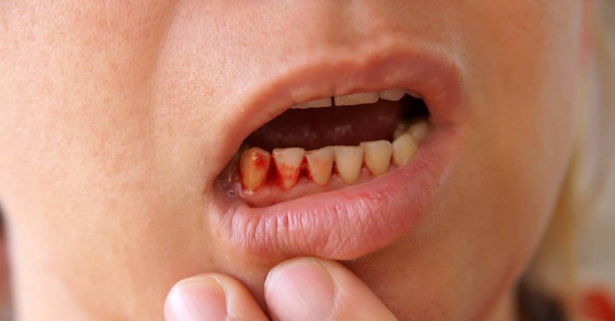 K vitamini hangi besinlerde bulunur? K vitamini koronavirüse iyi gelir mi? K vitamini eksikliği belirtileri...