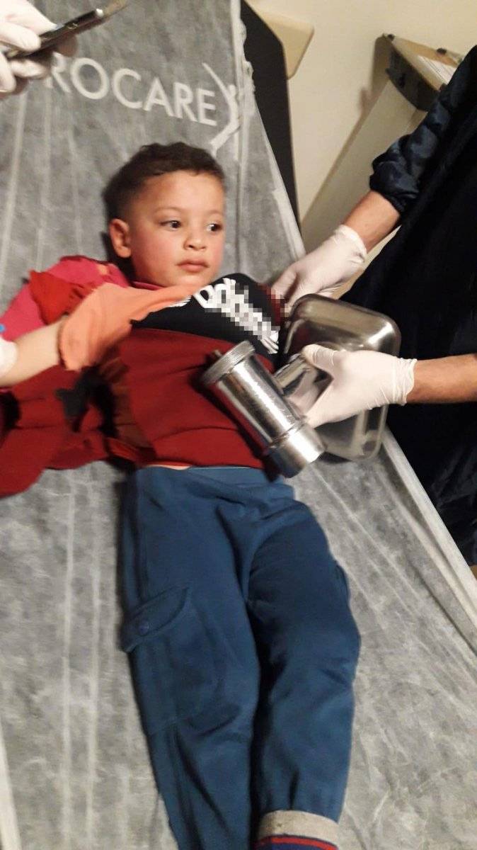 Eskişehir'de 3 yaşındaki çocuk, elini kıyma makinesine kaptırdı