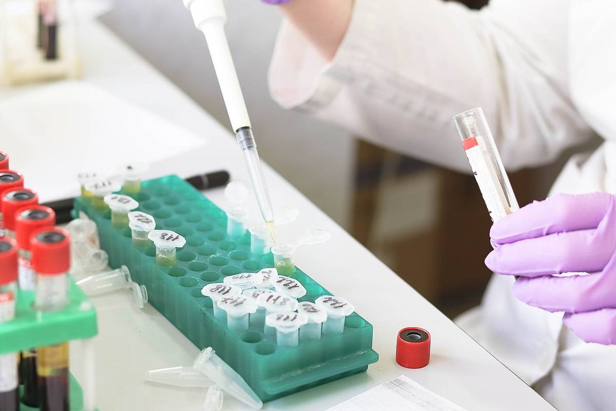 Kanser tedavisi öncesinde yumurtalar dondurulmalı