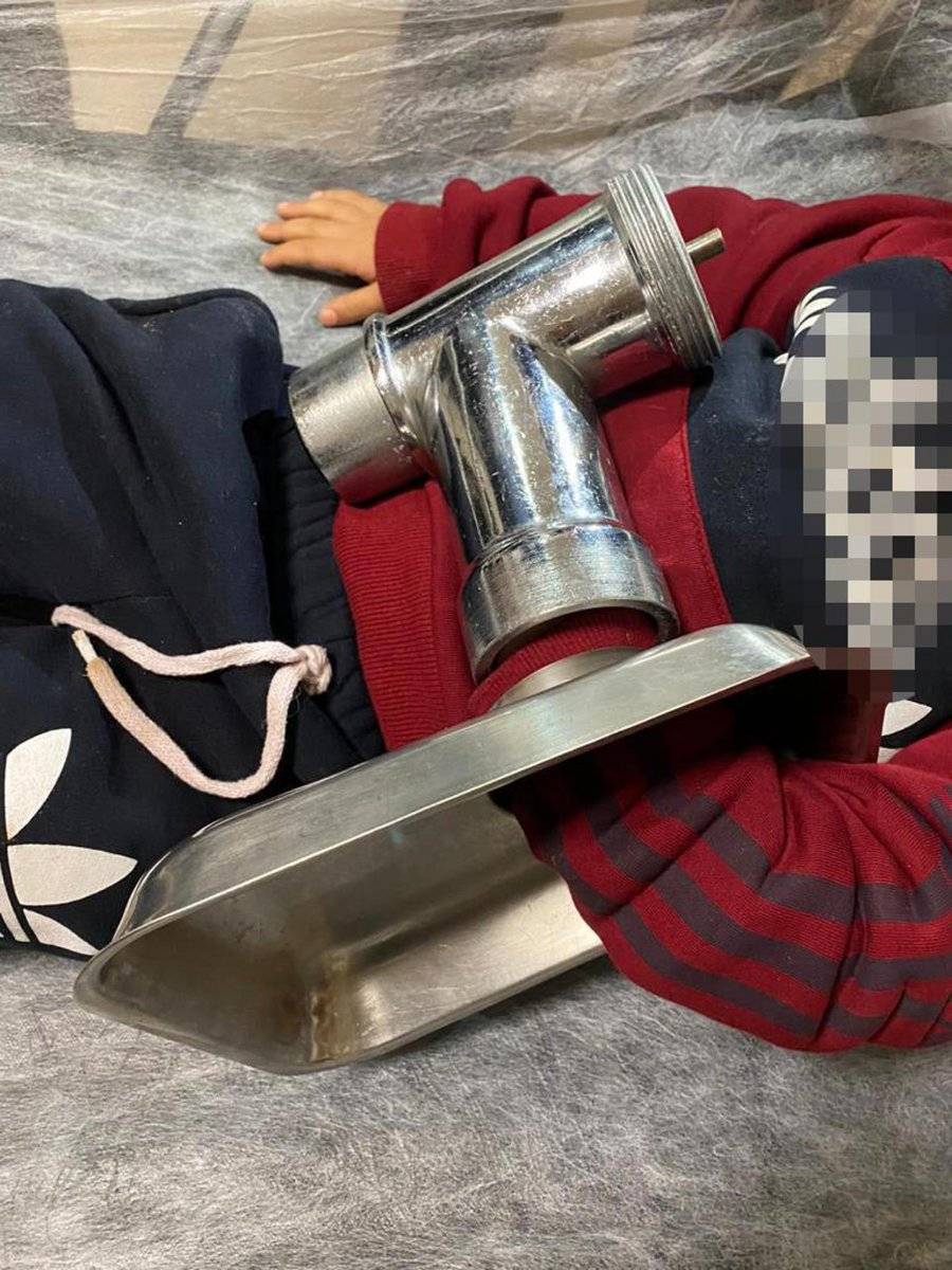 Eskişehir'de 3 yaşındaki çocuk, elini kıyma makinesine kaptırdı