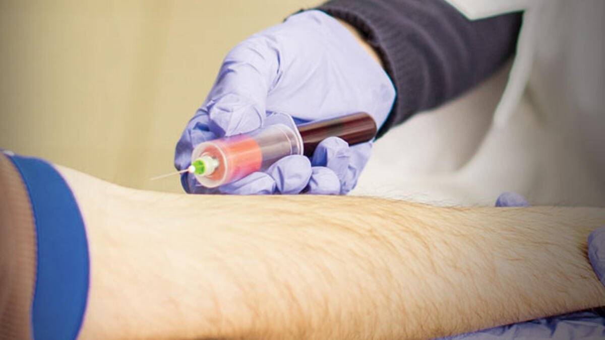 Hijyene dikkat ederek sarılık hastalığından korunmak mümkün