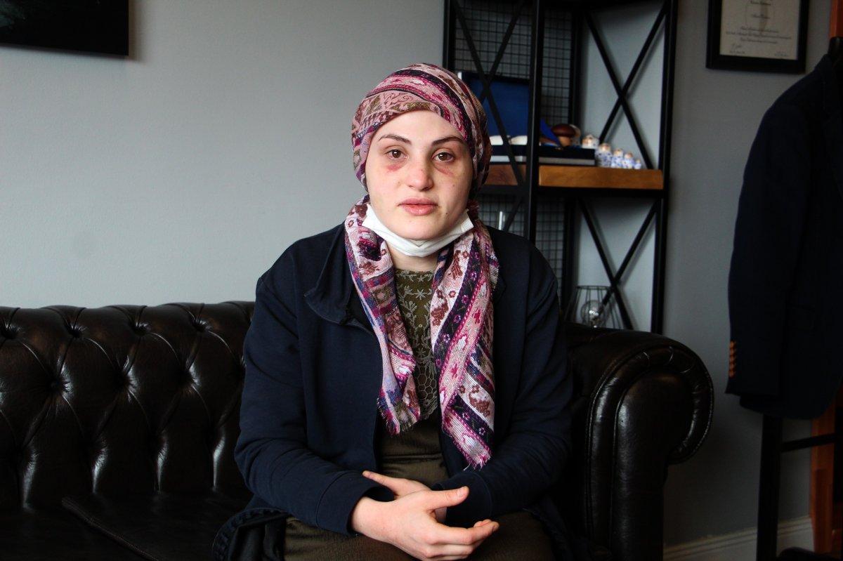 Antalya'da eşinden şiddet gören kadın