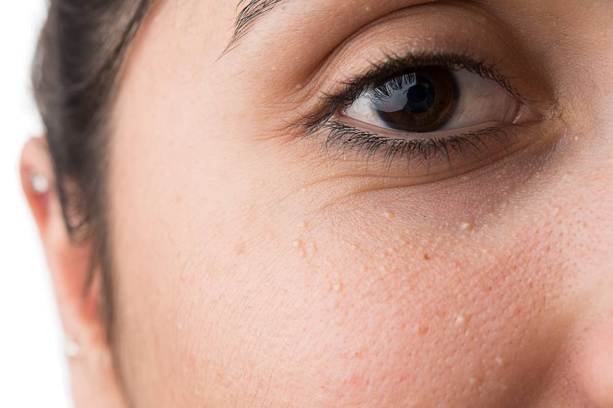 Yüzünüzün yaşlanmaya başladığını gösteren 8 işaret