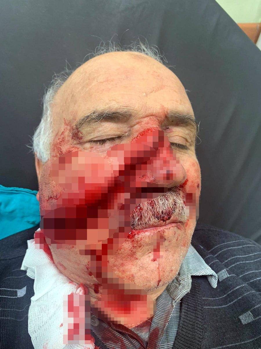 Kahramanmaraş'ta spiral makinesiyle demir keserken yüzü parçalandı