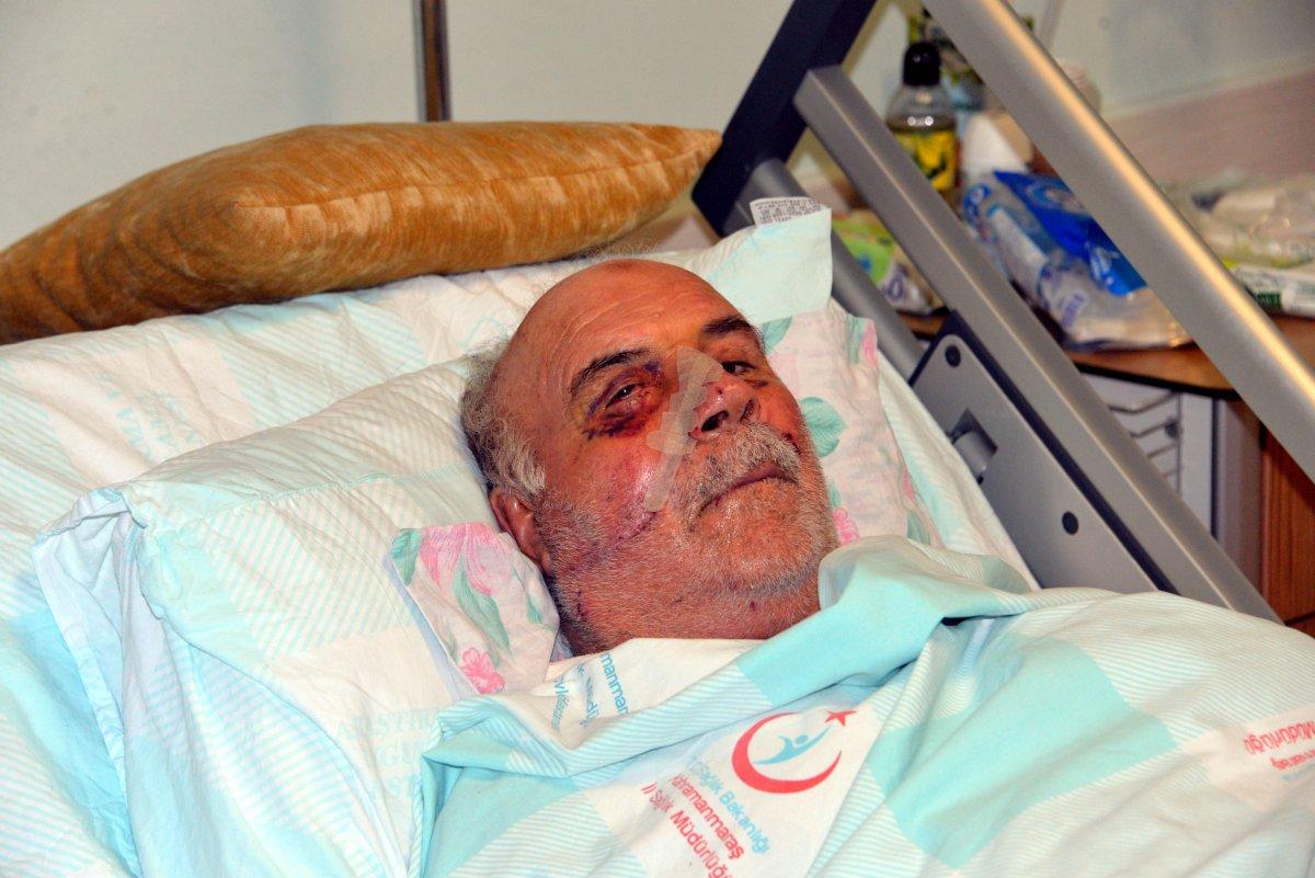 Kahramanmaraş'ta spiral makinesiyle demir keserken yüzü parçalandı