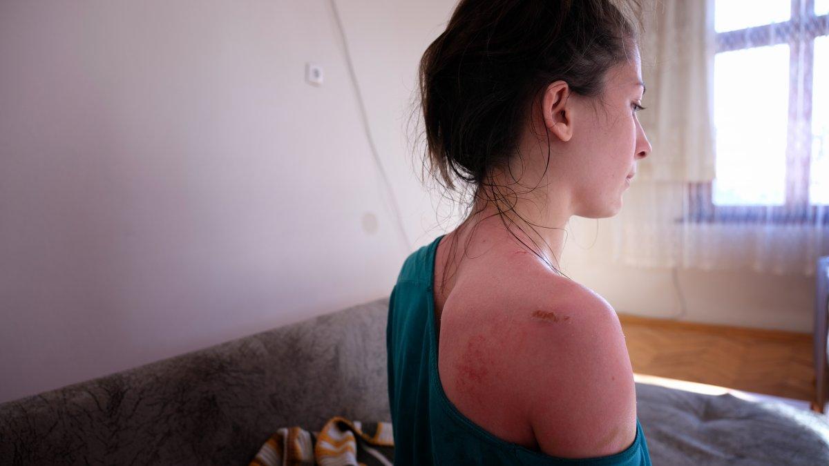 Konya'da eşi ve kızını sıcak suyla haşlayan zanlı için 6 yıl hapis istemi