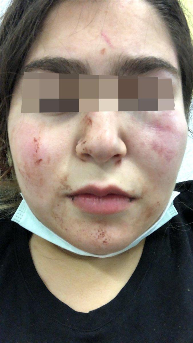 Alman polisinden Türk baba ile kızına şiddet