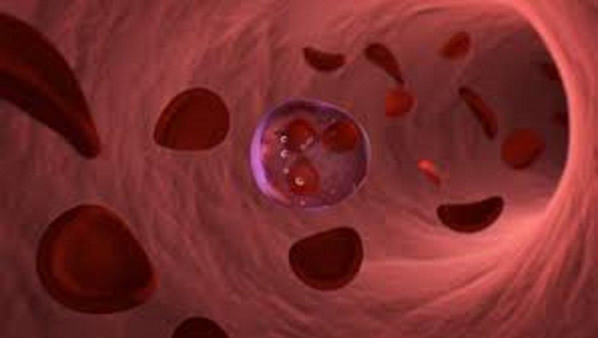 Hüner Coşkuner'in hastalığı neydi? Kemik iliği kanseri nedir, belirtileri nelerdir?